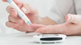 DexCom: DexCom‑Aktie explodiert: Hammer‑Zahlen – neue Übernahmefantasie?