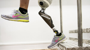 Ottobock: Verkauf geplant – die Details  / Foto: Andreas Arnold/picture alliance/dpa