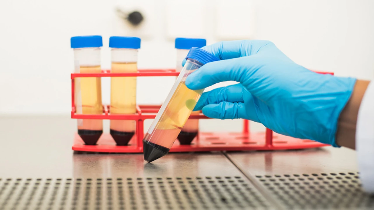 Biotech: Kampf gegen Krebs - diese Top-Projekte sollten Sie jetzt auf dem Schirm haben