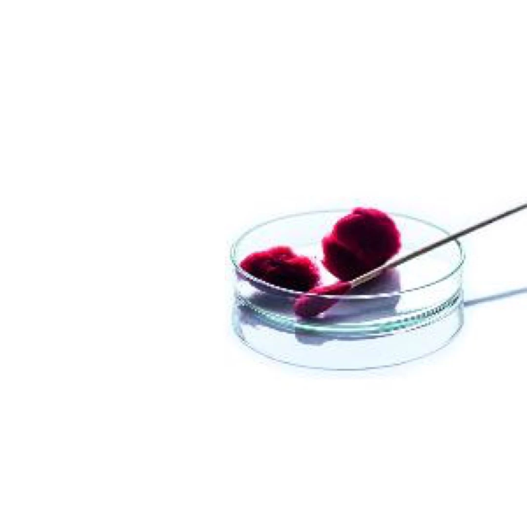 Abbvie nach Zahlen unter Druck: Ausgerechnet Mega-Blockbuster Humira setzt dem Pharma-Konzern zu. Übernahmen und Kooperationen sinnvoll, um Pipeline zu verbreitern. Kein Kauf.