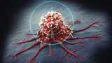 DAX: Hot‑Stock der Woche: Tumor im Fadenkreuz