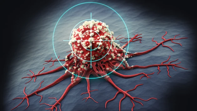 Hot‑Stock der Woche: Tumor im Fadenkreuz