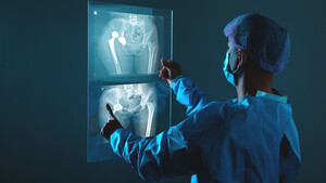 Auf die Knochen! Darum ist dieser AKTIONÄR‑Tipp jetzt ein Kauf  / Foto: Thitisan/Shutterstock