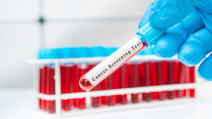 Paukenschlag: Samsung steigt bei GRAIL ein – Aktie schießt hoch  / Foto: WLADIMIR BULGAR/SCIENCE PHOTO LIBRARY/GettyImages