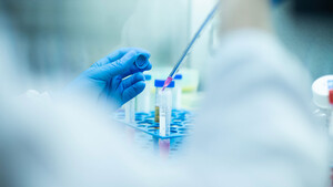 Hot‑Stock der Woche: Die Wette gilt 