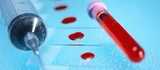 Epigenomics: Anlage‑Experten: Epigenomics liefert ein Insider‑Kaufsignal