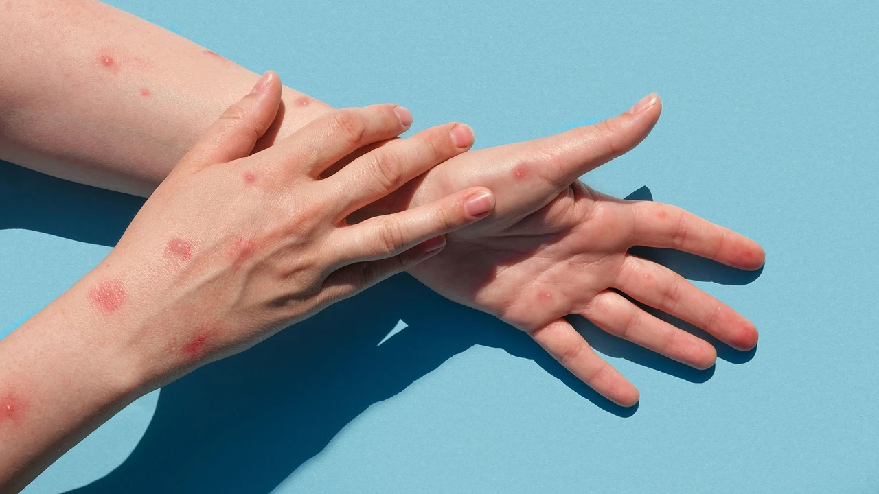 Die neue Bavarian Nordic? Affenpocken-Medikament mit Rally-Potenzial