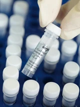 DAX: Morphosys‑Aktie holt wieder auf: Jetzt kaufen?