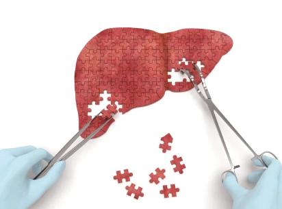Cash mit NASH: So geht es beim Fettleber-Hot-Stock Viking Therapeutics weiter