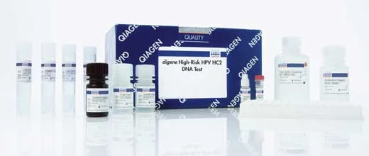 Qiagen: Aktie mit Kaufempfehlung – ist das die Trendwende?