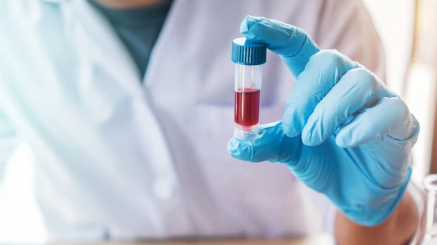 Auf den Spuren von Evotec und Morphosys: Aktienreport‑Tipp Zymeworks kratzt an der Marke von 100 Prozent
