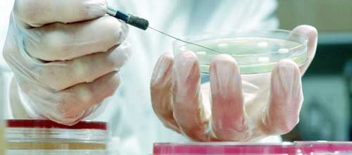 Evotec-Aktie: Nur ein Prozent Potenzial?