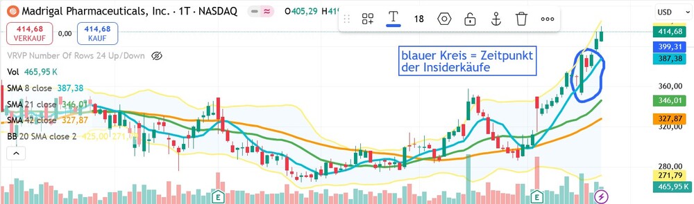 Madrigal Pharmaceuticals Inc. Chart