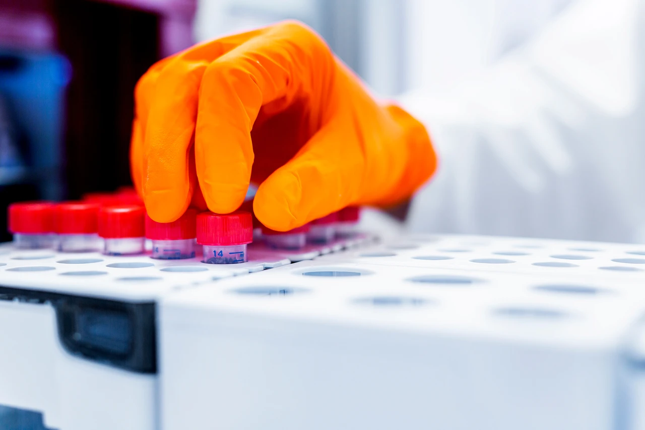 AKTIONÄR-Hot-Stock BioArctic: Nächste Zulassungen