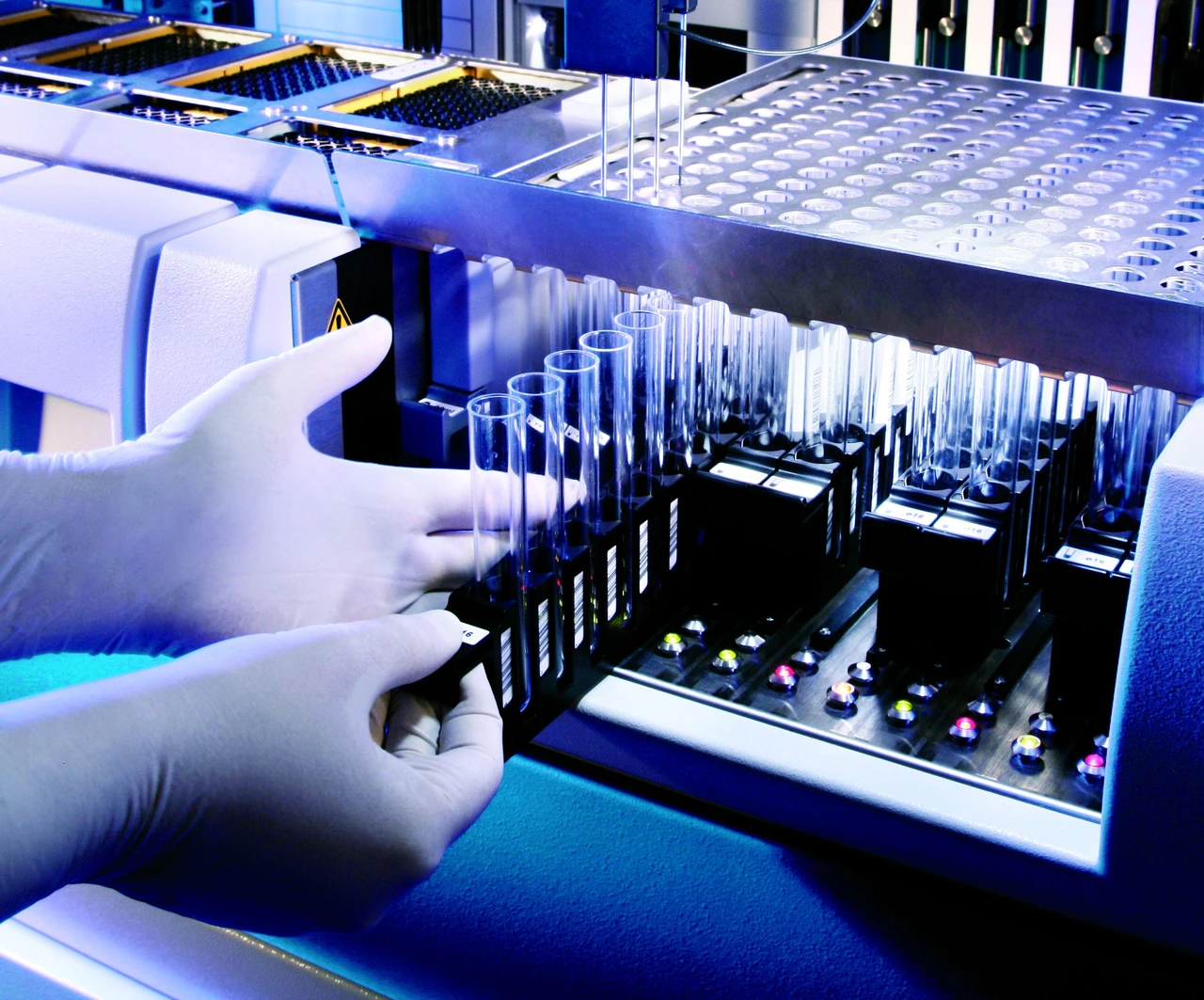 Stratec Biomedical +13% - Aktie nach Q3-Ergebnis nicht zu bremsen