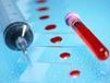 Epigenomics: Epigenomics: Patientenrekrutierung abgeschlossen