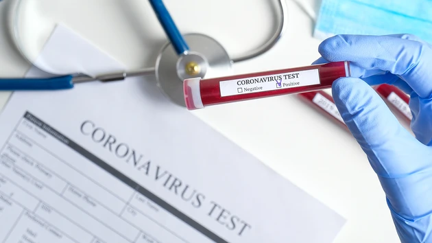 Gilead‑Aktie im Aufwind: Durchbruch im Kampf gegen das Coronavirus?