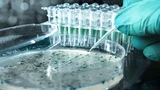 Zogenix Inc.: Zogenix‑Aktie schießt hoch: UCB schlägt zu – 72 Prozent Aufschlag